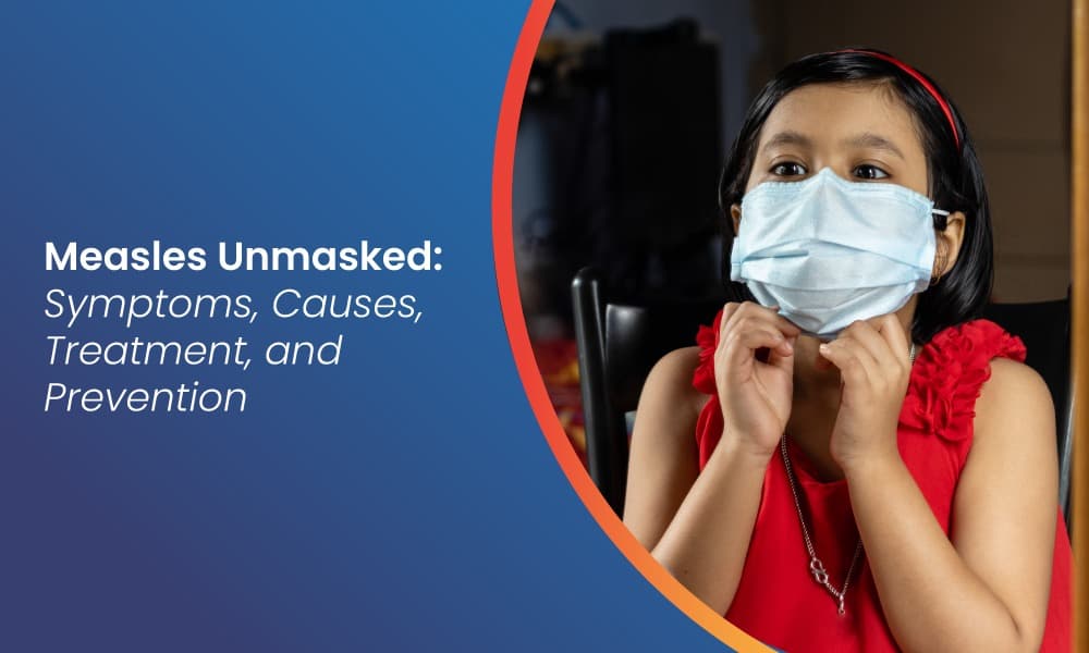 Measles Unmasked: Symptoms, Causes, Treatment, and Prevention